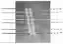 Fig. 02 - System and related method for positioning of surgically implanted neuro stimulation device electrodes