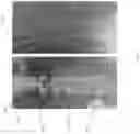Fig. 03 - System and related method for positioning of surgically implanted neuro stimulation device electrodes