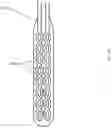Fig. 08 - System and related method for positioning of surgically implanted neuro stimulation device electrodes