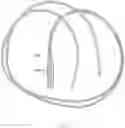 Fig. 09 - System and related method for positioning of surgically implanted neuro stimulation device electrodes