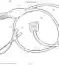 Fig. 10 - System and related method for positioning of surgically implanted neuro stimulation device electrodes
