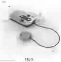 Fig. 05 - MEDICAL APPARATUS INCLUDING AN IMPLANTABLE SYSTEM AND AN EXTERNAL SYSTEM