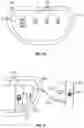 Fig. 17 - Wearable medical device with disposable and reusable components
