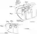 Fig. 20 - Wearable medical device with disposable and reusable components