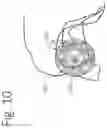 Fig. 12 - MAGNETIC DEVICE FOR TREATING LIVING TISSUES