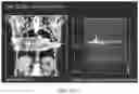 Fig. 37 - Multi-target treatment planning and delivery and virtual localization for radiation therapy