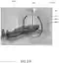 Fig. 47 - Multi-target treatment planning and delivery and virtual localization for radiation therapy