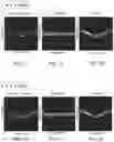 Fig. 58 - Multi-target treatment planning and delivery and virtual localization for radiation therapy