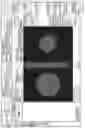 Fig. 63 - Multi-target treatment planning and delivery and virtual localization for radiation therapy