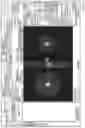 Fig. 71 - Multi-target treatment planning and delivery and virtual localization for radiation therapy