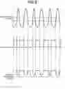Fig. 06 - Radiation therapy apparatus and radiation therapy method
