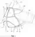 Fig. 02 - TIGHT FITTING RESPIRATOR WITH EXHALATION FILTER AND EXHALATION FILTER FOR TIGHT FITTING RESPIRATOR