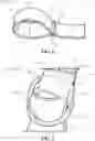 Fig. 04 - Stretching apparatus