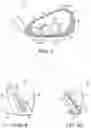 Fig. 04 - Ball striking device having a covering element