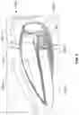 Fig. 10 - Multi-material golf club head