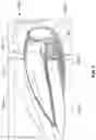 Fig. 10 - MULTI-MATERIAL GOLF CLUB HEAD