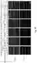 Fig. 11 - Apparatus and a method for patterning biological cells