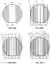 Fig. 09 - Laser-assisted method for parting crystalline material