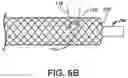 Fig. 13 - WELDING METHOD USING FIBER LASER FOR COMPONENTS OF A MEDICAL DEVICE