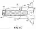 Fig. 14 - WELDING METHOD USING FIBER LASER FOR COMPONENTS OF A MEDICAL DEVICE