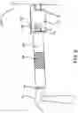 Fig. 07 - Staple Holding Device