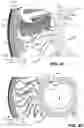 Fig. 07 - AUTOMATED FIBER PLACEMENT ROLLER