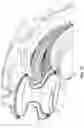 Fig. 14 - Pneumatic tire with annular sidewall concavity