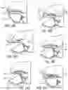 Fig. 13 - Vehicle interior component