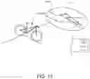 Fig. 11 - INTERACTIVE HANDLE FOR ELECTRICALLY ASSISTED VEHICLE