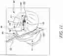 Fig. 12 - CLOSURE SYSTEM FOR CONTAINER