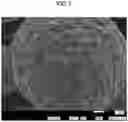 Fig. 07 - POSITIVE ELECTRODE ACTIVE MATERIAL FOR LITHIUM ION SECONDARY BATTERY, METHOD OF MANUFACTURING POSITIVE ELECTRODE ACTIVE MATERIAL FOR LITHIUM ION SECONDARY BATTERY, AND LITHIUM ION SECONDARY BATTERY
