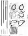 Fig. 38 - Recombinant lubricins, and compositions and methods for using the same