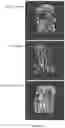 Fig. 31 - BMP-ALK3 ANTAGONISTS AND USES FOR PROMOTING BONE GROWTH