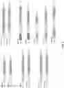 Fig. 03 - Multi-functional and multi-valent interleukin-TGF-beta receptor fusion polypeptides