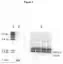 Fig. 04 - METHODS AND COMPOSITIONS FOR INCREASING N-ACETYLGLUCOSAMINIDASE ACTIVITY IN THE CNS