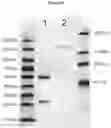 Fig. 11 - METHODS AND COMPOSITIONS FOR INCREASING N-ACETYLGLUCOSAMINIDASE ACTIVITY IN THE CNS