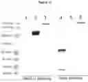 Fig. 12 - METHODS AND COMPOSITIONS FOR INCREASING N-ACETYLGLUCOSAMINIDASE ACTIVITY IN THE CNS