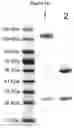 Fig. 15 - METHODS AND COMPOSITIONS FOR INCREASING N-ACETYLGLUCOSAMINIDASE ACTIVITY IN THE CNS