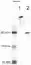 Fig. 16 - METHODS AND COMPOSITIONS FOR INCREASING N-ACETYLGLUCOSAMINIDASE ACTIVITY IN THE CNS