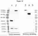 Fig. 17 - METHODS AND COMPOSITIONS FOR INCREASING N-ACETYLGLUCOSAMINIDASE ACTIVITY IN THE CNS