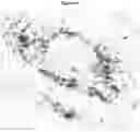 Fig. 19 - METHODS AND COMPOSITIONS FOR INCREASING N-ACETYLGLUCOSAMINIDASE ACTIVITY IN THE CNS