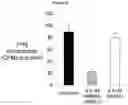 Fig. 20 - METHODS AND COMPOSITIONS FOR INCREASING N-ACETYLGLUCOSAMINIDASE ACTIVITY IN THE CNS