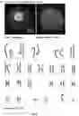 Fig. 14 - A Self-Assembling Short Amphiphilic Peptide And Related Methods And Uses