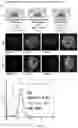 Fig. 15 - A Self-Assembling Short Amphiphilic Peptide And Related Methods And Uses