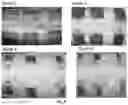 Fig. 18 - A Self-Assembling Short Amphiphilic Peptide And Related Methods And Uses