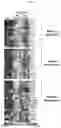 Fig. 44 - GENETICALLY MODIFIED HEMATOPOIETIC STEM AND PROGENITOR CELLS (HSPCS) AND MESENCHYMAL CELLS AS A PLATFORM TO REDUCE OR PREVENT METASTASIS, TREAT AUTOIMMUNE AND INFLAMMATORY DISORDERS, AND REBALANCE THE IMMUNE MILIEU AND DYSREGULATED NICHES