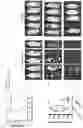 Fig. 61 - GENETICALLY MODIFIED HEMATOPOIETIC STEM AND PROGENITOR CELLS (HSPCS) AND MESENCHYMAL CELLS AS A PLATFORM TO REDUCE OR PREVENT METASTASIS, TREAT AUTOIMMUNE AND INFLAMMATORY DISORDERS, AND REBALANCE THE IMMUNE MILIEU AND DYSREGULATED NICHES