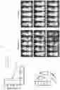 Fig. 62 - GENETICALLY MODIFIED HEMATOPOIETIC STEM AND PROGENITOR CELLS (HSPCS) AND MESENCHYMAL CELLS AS A PLATFORM TO REDUCE OR PREVENT METASTASIS, TREAT AUTOIMMUNE AND INFLAMMATORY DISORDERS, AND REBALANCE THE IMMUNE MILIEU AND DYSREGULATED NICHES