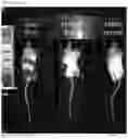Fig. 13 - COMPOSITIONS AND METHODS FOR STEM CELL THERAPY