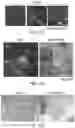 Fig. 13 - MULTICELLULAR INTEGRATED BRAIN TISSUE IN NEUROLOGICAL DISEASES